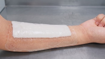 Antebrazo humano con un parche rectangular de hidrogel blanco translúcido, adherido a la piel y cubriendo desde la muñeca hacia el codo