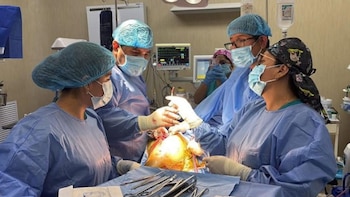 La utilización de una prótesis