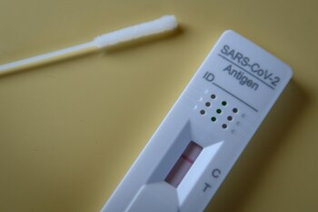 EFE/EPA/PHILIPP GUELLAND/Archivo