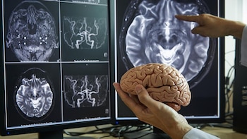 Un estudio descubre que el