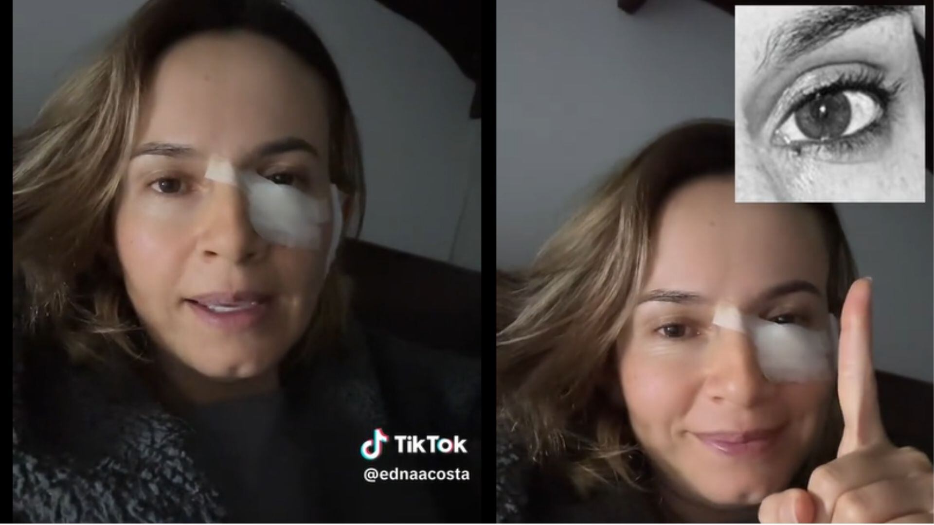 El testimonio de Edna Acosta en TikTok busca que más personas consulten al especialista ante cualquier lunar o lesión sospechosa - crédito composición fotográfica
