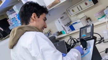Cómo una gota de sangre permite detectar el Alzheimer antes de que aparezcan los primeros síntomas