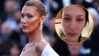 Bella Hadid atraviesa nueva recaída por la enfermedad de Lyme: “Nada ayuda todavía”