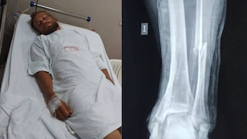 Ciclista ruso atropellado en Áncash