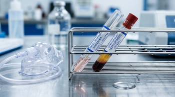 Gradilla metálica con dos tubos de ensayo etiquetados y una mascarilla de nebulización transparente sobre una superficie de acero inoxidable.