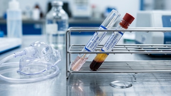 República Dominicana acumula 279 casos de leptospirosis y nueve diagnósticos de tosferina en lo que va de 2026