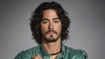 Manuel Masalva, actor de la serie Narcos, habla por primera vez sobre la amputación que sufrió tras contraer bacteria