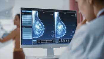 Uno de cada tres ensayos clínicos en Perú se concentra en el cáncer: qué significa para los pacientes