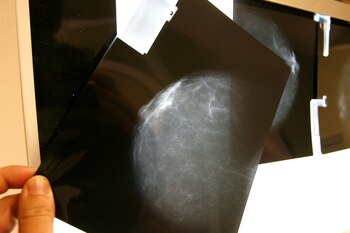 La detección temprana de mutaciones