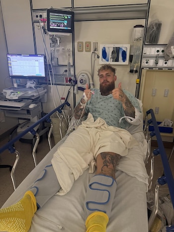 Jake Paul fue operado de