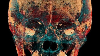 El daño impedía a la