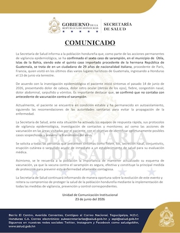 La Secretaría de Salud confirmó seis casos de sarampión en Honduras. (FOTO: Secretaría de Salud)