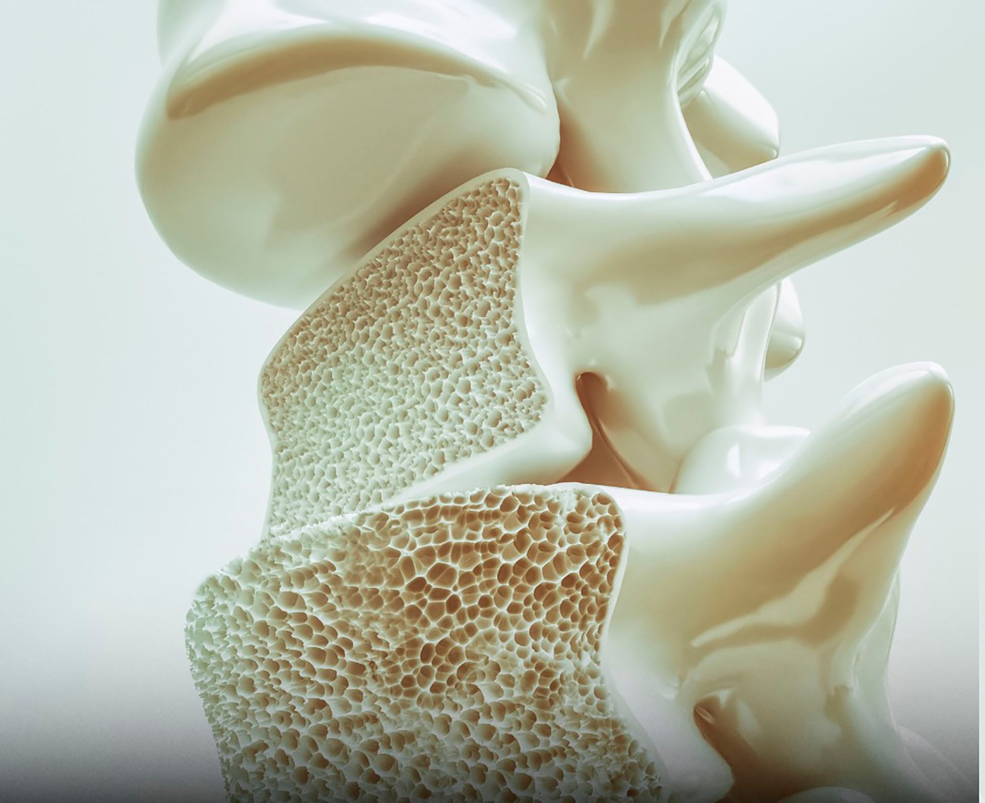 La osteoporosis afecta a millones de personas y provoca más de dos millones de fracturas anuales en todo el mundo, según datos de Harvard