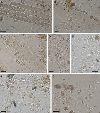 Siete micrografías muestran fragmentos celulares alargados e irregulares, material granular y partículas oscuras sobre un fondo claro, con barras de escala