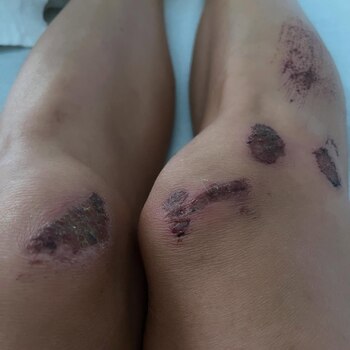 El drama de la esposa del ex F1 Romain Grosjean