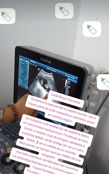 El equipo médico busca prolongar el tiempo de gestación para favorecer el desarrollo de los cuatro bebés - crédito cuatrillizos Caucasia/TikTok