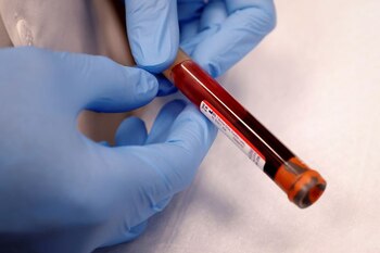 Un vial de sangre tras un estudio de anticuerpos al coronavirus en un suburbio de Nueva York (REUTERS/Mike Segar)