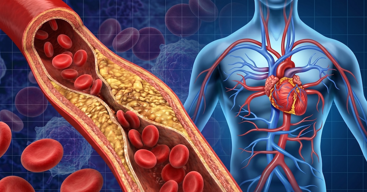 La condición física en la juventud predice la salud arterial tres décadas después