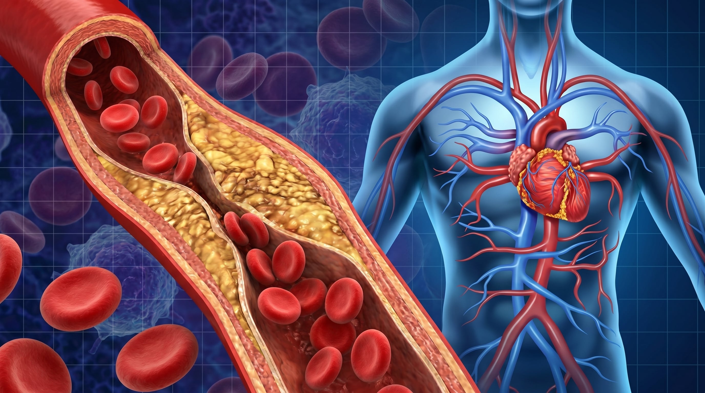 Incluir jengibre en la dieta puede apoyar el control del colesterol, disminuir triglicéridos y mejorar la salud cardiovascular (Imagen Ilustrativa Infobae)