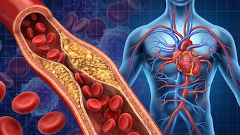 Hipertensión, obesidad y colesterol elevado pueden aumentar hasta un 30% el riesgo de cáncer, alerta un estudio