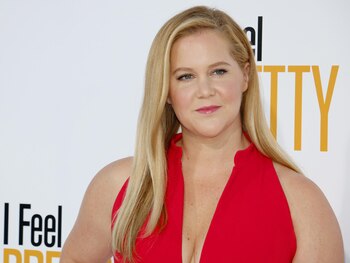 La actriz y comediante Amy Schumer contó que tiene síndrome de Cushing, para concientizar sobre la importancia de no opinar de los cambios corporales