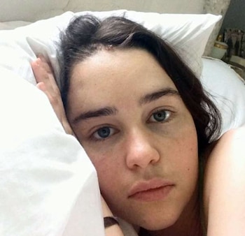 La actriz británica Emilia Clarke ha relatado en un podcast los momentos más críticos de sus cirugías cerebrales.