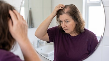Mujer de 55 años con remera morada se mira al espejo, con una mano en la cabeza, revelando zonas con adelgazamiento capilar visible.