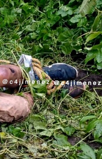 La mujer tenía signos de