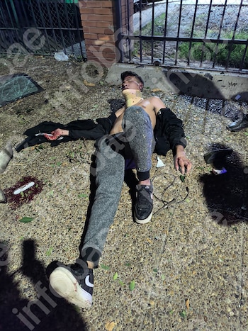 Hombre joven tumbado en suelo de guijarros con collarín cervical, chaqueta abierta, pantalones grises y zapatillas. Sangre en su mano y en el suelo