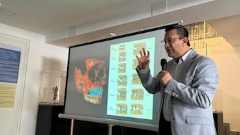 Un hombre sostiene un micrófono y gesticula frente a una pantalla de proyección que muestra imágenes de un cráneo y diagramas de dientes