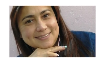 Yulixa Consuelo Toloza se hizo un procedimiento estético en Beauty Laser - crédito Yulixa Tolosa/Facebook