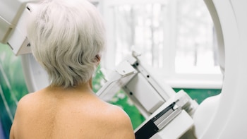 Mamografías: permitir que las mujeres
