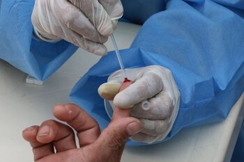 Al principio, existía la preocupación