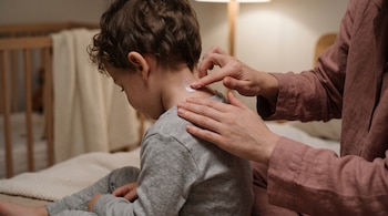 Las manos de una mujer aplican una porción de crema blanca en la nuca de un niño de espaldas sentado sobre una cama.