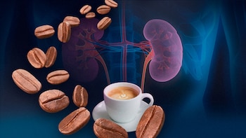 Los riñones y el café: cuántas tazas al día son seguras y qué precauciones deben tener las personas con hipertensión