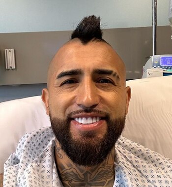 Arturo Vidal fue intervenido tras