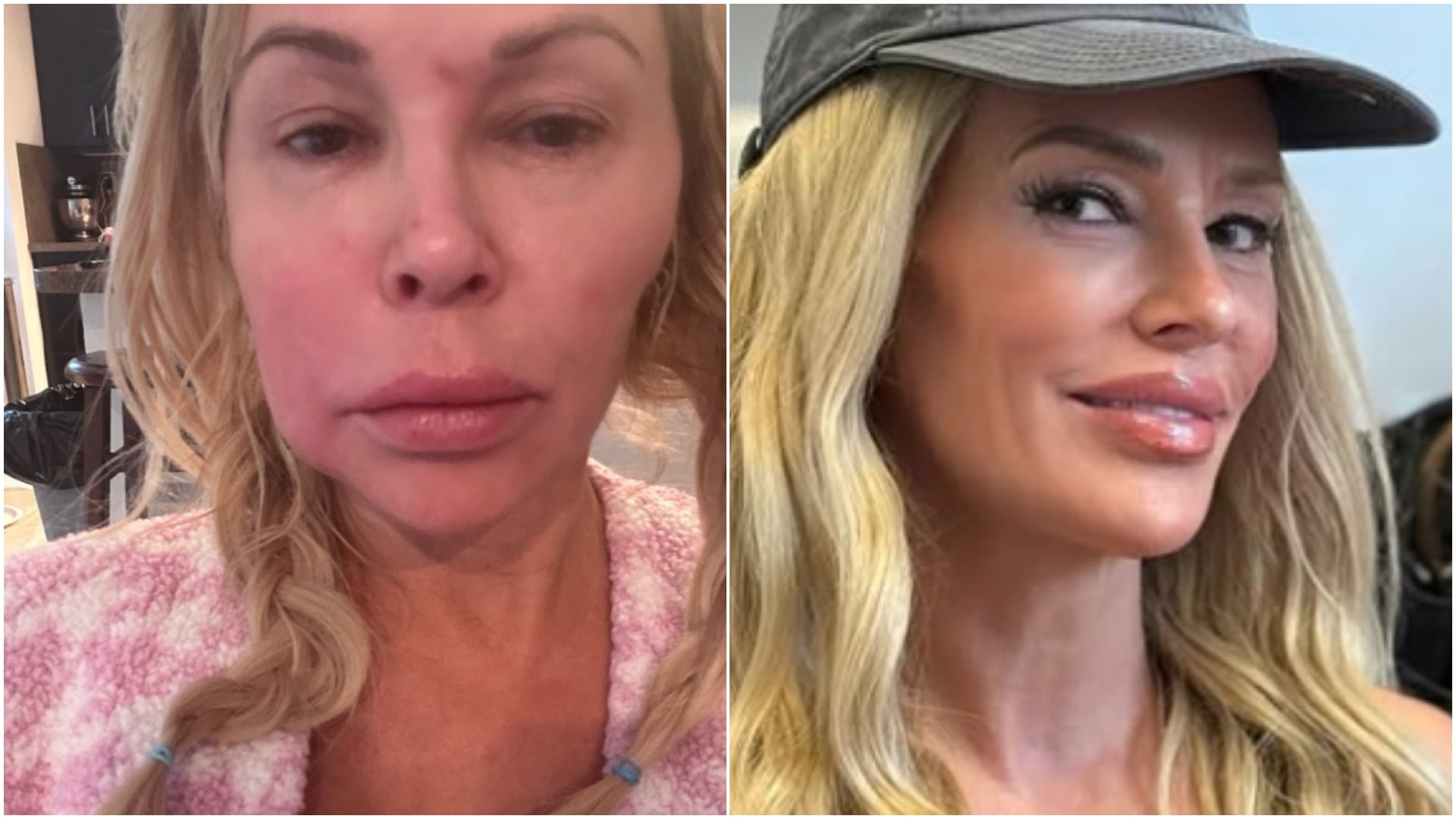 Tras casi tres años de consultas y explicaciones cambiantes, Brandi Glanville mantiene abierto un cuadro de parálisis facial y malestar cotidiano sin un diagnóstico definitivo - (Instagram/@brandiglanville)