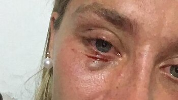 La última trompada que sufrió