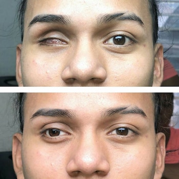 Giovanni, antes y después de