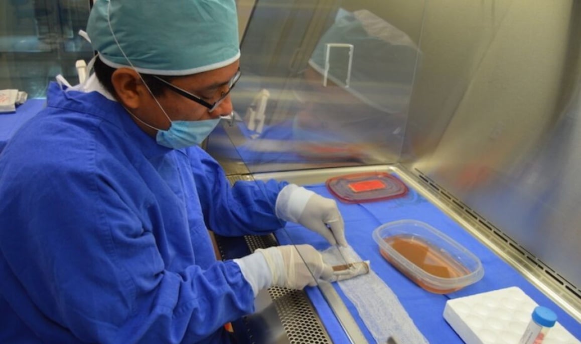 La piel de cerdo se convierte en apósitos biológicos temporales para proteger heridas de pacientes con quemaduras graves en Perú.