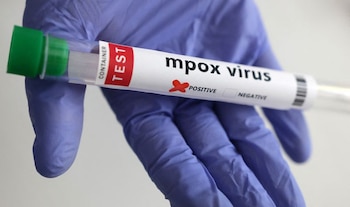 Personal sanitario del Ministerio de Salud y del INCIENSA participa en la investigación epidemiológica tras la detección de dos casos de viruela símica en San José. REUTERS/Dado Ruvic