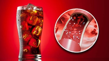 Altos niveles de azúcar, sodio