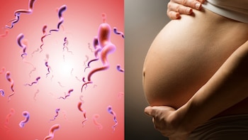 Sífilis en Perú: una infección curable que puede avanzar sin síntomas y complicar el embarazo