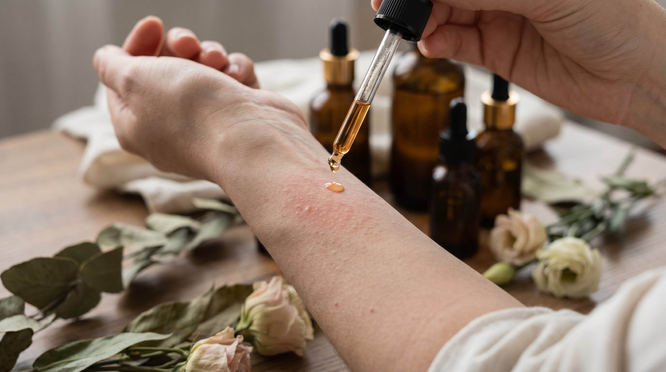 Los aceites esenciales pueden causar irritación en la piel, trastornos respiratorios y efectos digestivos, además de agravar síntomas de alergias (Imagen Ilustrativa Infobae)