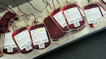 Demuestran los beneficios de transfundir