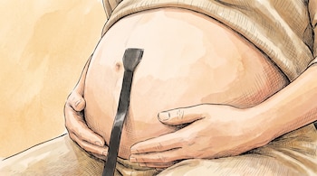 Ilustración de un vientre de mujer embarazada con las manos rodeándolo y un dispositivo médico oscuro apoyado en el ombligo.