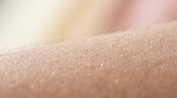Primer plano macro de la piel humana con vello velloso, líneas finas y poros. El vello es corto y oscuro, con fondo desenfocado en tonos crema y rosa.
