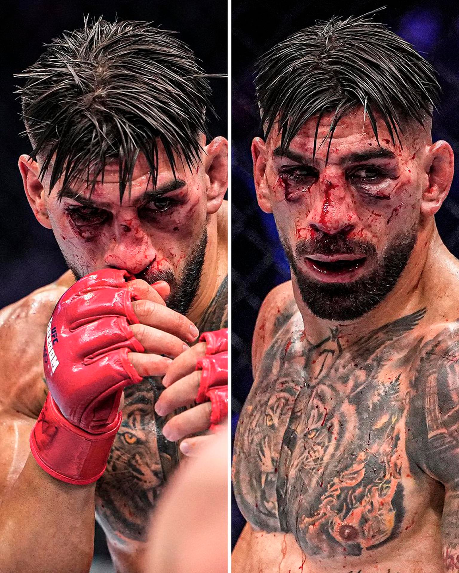 Las severas consecuencias físicas de su reciente combate, con su rostro cubierto de sangre y marcas evidentes de la intensa pelea.