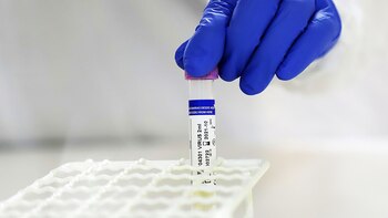 Los pacientes con cuadros leves