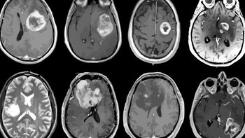 O algodoeiro pode ajudar a